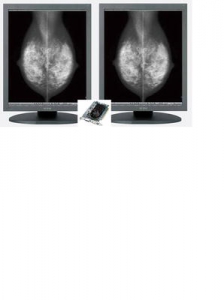 Dobbel medical monitor med grafikkort
